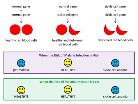 sickle cell anemia and malaria